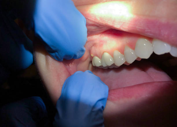 Best Weekend Emergency Dental Services in Terra Alta, WV