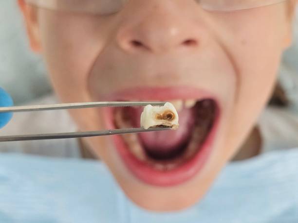 Best Emergency Care for Gum Disease in Terra Alta, WV